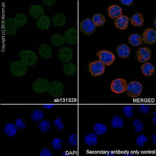 Other settings are already installed by default. Recombinant Anti Nme2 Antibody Epr8351 Ab131329 Abcam