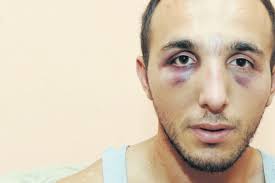 Kolasin policemen: The arrested man attacked us, he also did push-ups