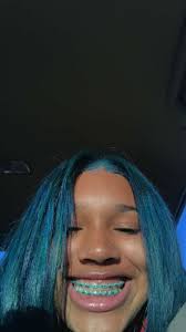 Black And Light Blue Braces Pin Iamsunny00 Braces Colors Cute Braces Cute Braces Colors