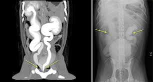 Ea strange urina care vine prin uretere, atunci cand este plina, o. Unitatea OperativÄƒ VeterinarÄƒ Pentru IncontinenÅ£Äƒ UrinarÄƒ Istituto Veterinario Di Novara