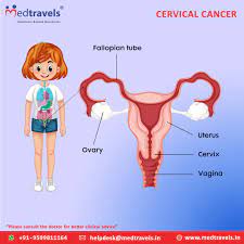 Bleeding after menopause can be disconcerting, but the good news is, more than 90% of the time if you have any spotting after menopause do go in and get it checked out!!! Medtravels On Twitter Vaginal Bleeding Between Periods Or After Menopause Can Be An Indicator Of Cervical Cancer Visit Our Site For More Details Https T Co Bkez0cuipm Cancertreatment Treatment Chemotherapy Treatmentinindia Bladdercancer