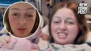 Woman pushed so hard while giving birth that her eye ‘popped out’