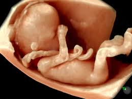 Image result for First Trimester Ultrasound
