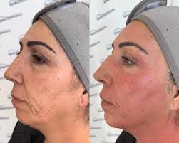 Ana Chamorro Estética...