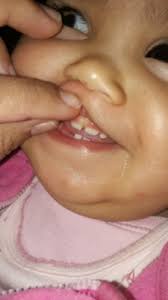Manchitas Blancas En El Diente Club Septiembre 2019 Embarazo Y Bebes Babycenter