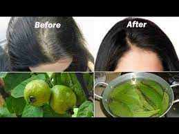 Hair loss is a widely prevalent issue that affects both men and women. Youtube Hairfall Treatment Hair Loss Prevent Hair Loss