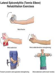 Manual therapy and exercise for lateral elbow pain. the cochrane database of systematic reviews 2018.6 (2018). Elbow Exercises Active Care Physiotherapy Clinic