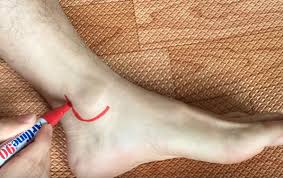 Pin On 1