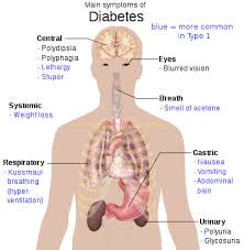 Type 2 Diabetes Wikipedia