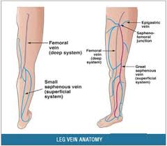 To diagnose varicose veins, your doctor will do a physical exam, including looking at your legs while you're standing to check for swelling. Common Myths About Varicose Veins Wake Radiology