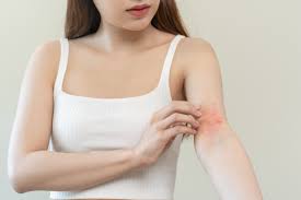 Inflamación tipo 2: el origen oculto detrás de enfermedades como la  dermatitis atópica | Yo Dona para UEStudio