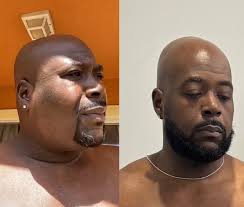 Nobody told me anything. Well im here to tell all of you, start ya health  journey immediately! Dont say u happy being out of shape because your  lying. Nobody would choose to