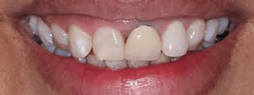 Maybe you would like to learn more about one of these? Home Bethlehem Dentist Gentle Dental Group Bethlehem Ga