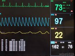 What Are The Different Types Of Vital Signs Charts