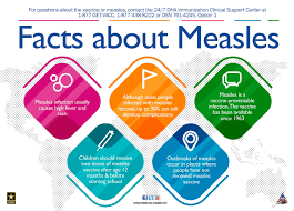 These side effects began on average 2 days after vaccination. Measles Is Back Article The United States Army