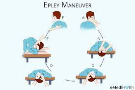 The home epley maneuver is a type of exercise help that helps to treat the symptoms of benign paroxysmal positional vertigo (bppv). 7 Home Remedies Exercises To Stop Vertigo Emedihealth