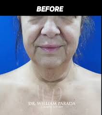 If you had surgery with dr gebal matos, how was your experience with him?