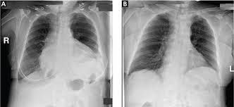 Image result for Silhouette Sign