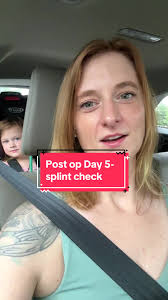 Francesca Swollen Feet