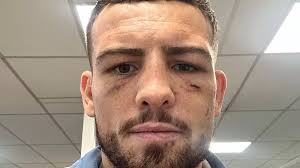 Dad has side-hustle as bare-knuckle boxer and earns £15,000 a fight