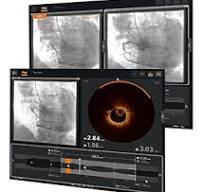 Intravascular Imaging | Abbott