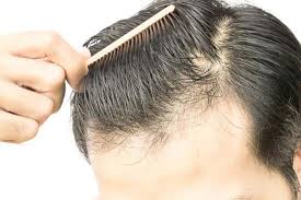 Understanding more about how the hair growth cycle works can better help us to see what role any and/or all of those processes play in what kind of hair loss may inevitably affect us overall. 25 Ways To Prevent Hair Loss For Men Man Matters