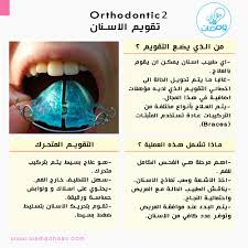 اعرف أكثر عن التقويم المتحرك المصدر www dentalhealth org المؤسسة البريطانية لصحة الاسنان rami bassa turquoise ring gemstone rings rings