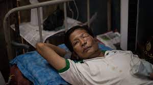 Que es el hongo negro la nueva secuela de la covid que siembra el miedo en india as com from as01.epimg.net. Que Es El Peligroso Hongo Negro Que Asocian Al Covid Y Por Que Alarma Al Mundo En Plena Pandemia