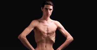 The Truth About Male Eating Disorders