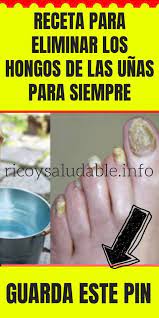 Esta Receta Super Facil De 2 Ingredientes Eliminara Los Hongos De Las Unas Para Siempre Eliminar Hongos De Las Unas Remedio Para Hongos Hongos Unas Pies