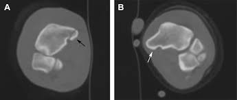Computed Tomography Of The Musculoskeletal System Veterinary Clinics Small Animal Practice