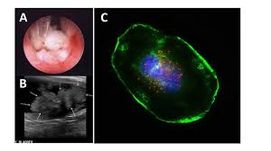 They should be able to help you with diet adjustments and plans that will help your dog in their healing process. Anthrax May Be The Next Tool In The Fight Against Bladder Cancer Eurekalert Science News