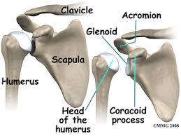 Image result for Chronic Shoulder Dislocation