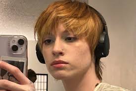 Fundraiser by Aedan Fae : Help Overcome Painful Cysts with Surgery