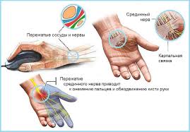 Bolyat Kisti Ruk Set Klinik Zdravstvuj