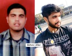 Fattofit How I Lost 25 Kilos In 2 Months Rediff Com Get Ahead