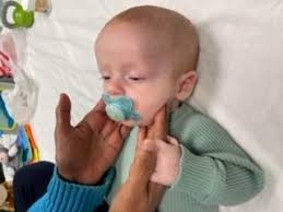 Image result for Floppy Infant