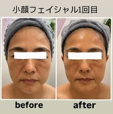 改原美保｜リンパ・美容整体・小顔矯正の先生 (@kaihara_miho_lunon) • Instagram photos and videos