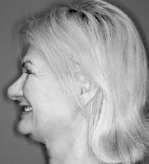 Neuromuscular Orthotics in the Treatment of Craniomandibular Dysfunction  and the Effects