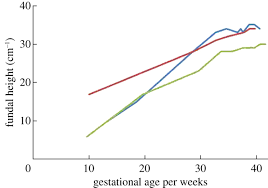 Estimation Of Gestational Age From Fundal Height A Solution