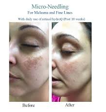 Pin On Beauty Remedies
