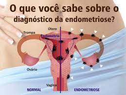 pin em gineco obstetricia