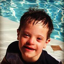 How Your Child Can Be Featured In A Babble Down Syndrome Awareness Article