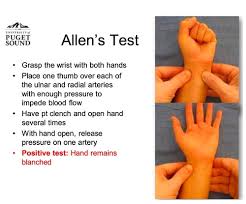 Image result for Allen Test