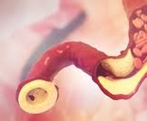 الاخ ايفينيس والاخت دالين شكرا لمروركن. Ø¯ÙˆØ§Ø¡ Ø±ÙˆØ²ÙˆÙØ§Ø³ØªØ§ØªÙŠÙ† Ù„Ø¹Ù„Ø§Ø¬ Ø§Ø±ØªÙØ§Ø¹ Ø§Ù„ÙƒÙˆÙ„Ø³ØªØ±ÙˆÙ„ ÙˆÙŠØ¨ Ø·Ø¨