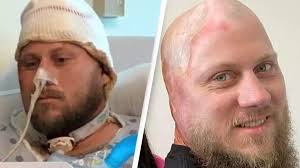 Man who was electrocuted by 4,160 volts horrifically watched his 'skin  melt'