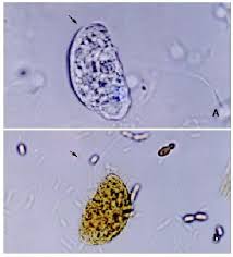 Image result for Balantoides Coli