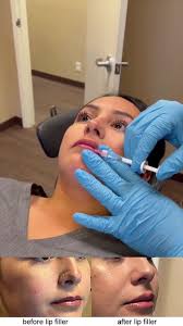 Jason Sabet-Peyman, MD