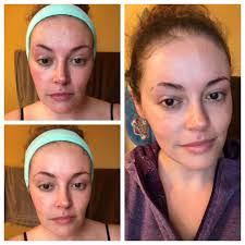 If you have been or currently are a Skin & Bare It client and have worked  with me