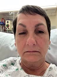 Any advice for managing Reclast infusion side effects?